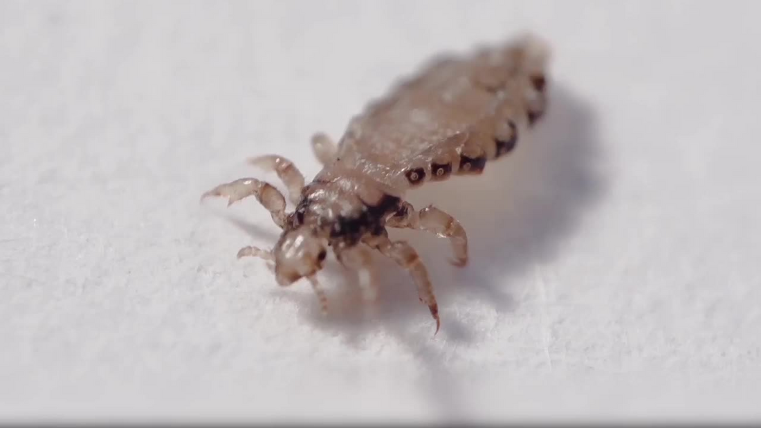 How to Cure Lice Infestations Without Chemicals